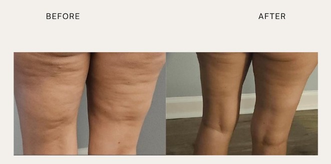 Destin Weight Loss & Wellness